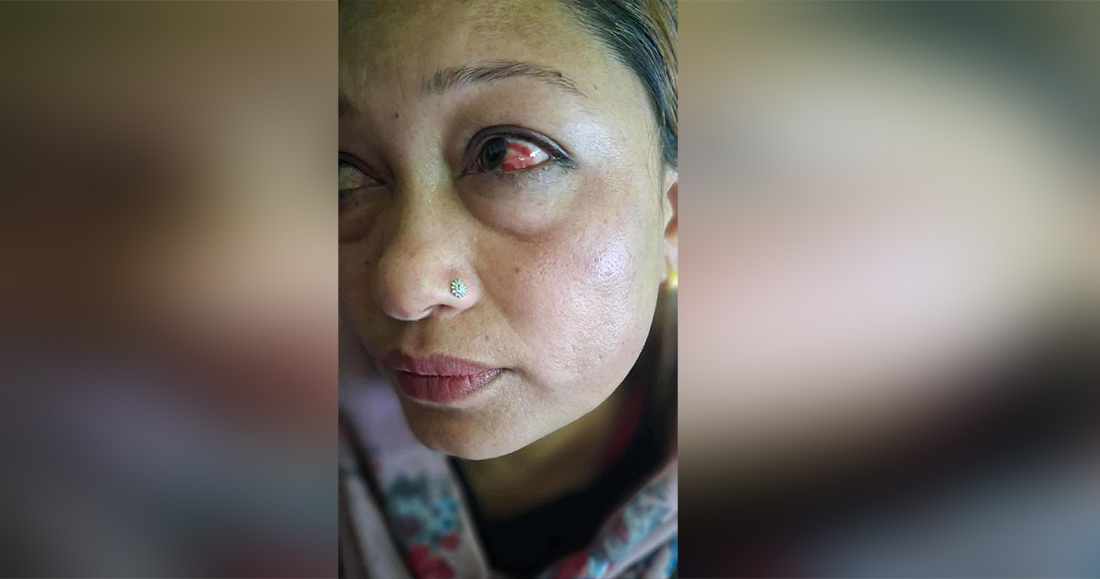 विद्यालय व्यवस्थापन समितिको अध्यक्षले बैठकमै कुटे प्रधानाध्यापक